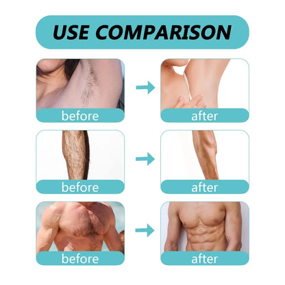 Ecrin Hair Removal Spray for Men and Women - 150 ml