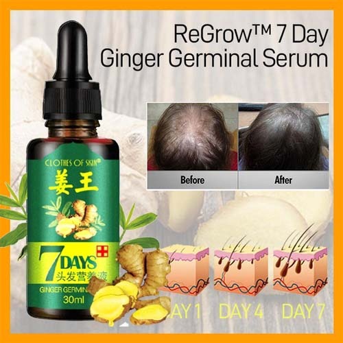 Ginger Germinal Oil Hair Nutrient Solution Hair Growth (30ml) - 50% OFF