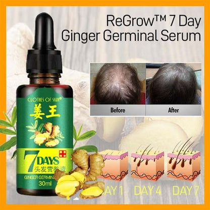 Ginger Germinal Oil Hair Nutrient Solution Hair Growth (30ml) - 50% OFF