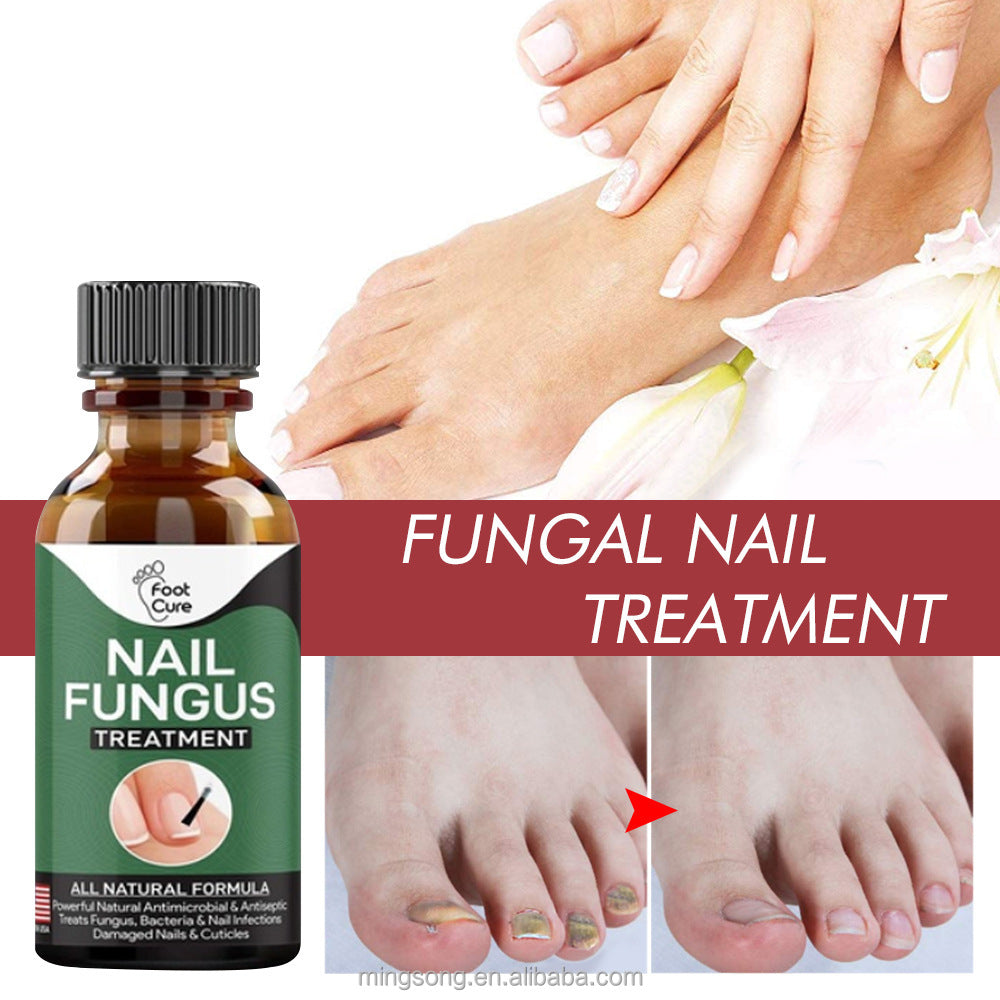 Famedeals.pk™ - Nail Fungi Treatment Serum