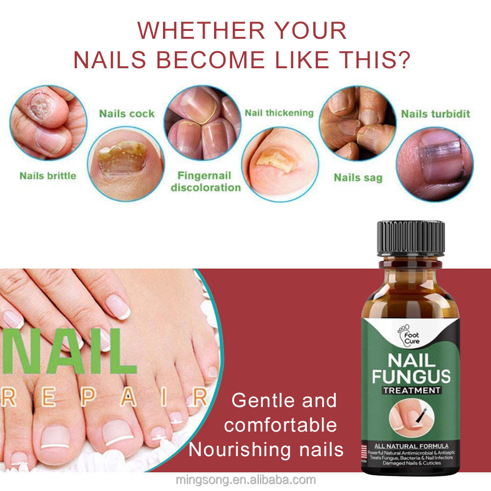 Famedeals.pk™ - Nail Fungi Treatment Serum